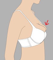 over flow of top bra