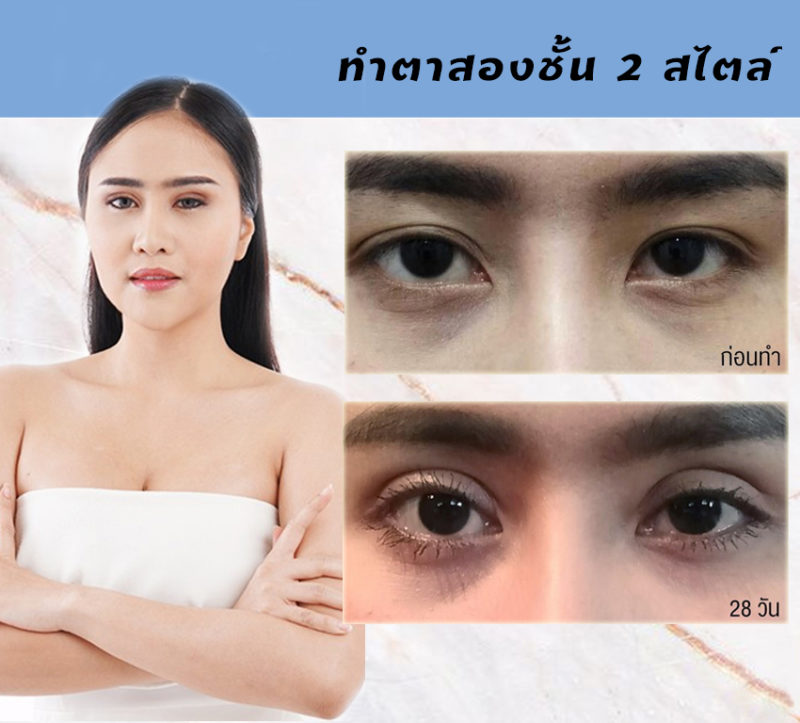 ทําตาสองชั้นที่ไหนดี 2564 pantip