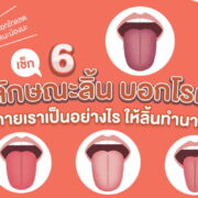 ลักษณะของลิ้นบอกโรค