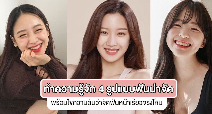 braces for face shape